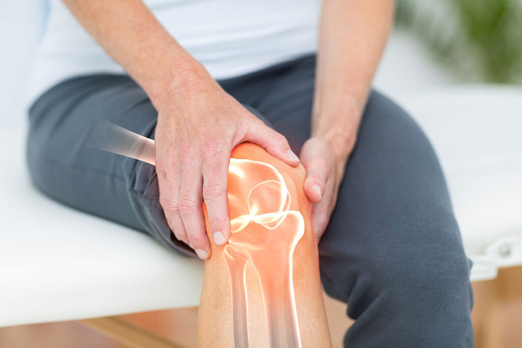 Osteoartrita genunchiului